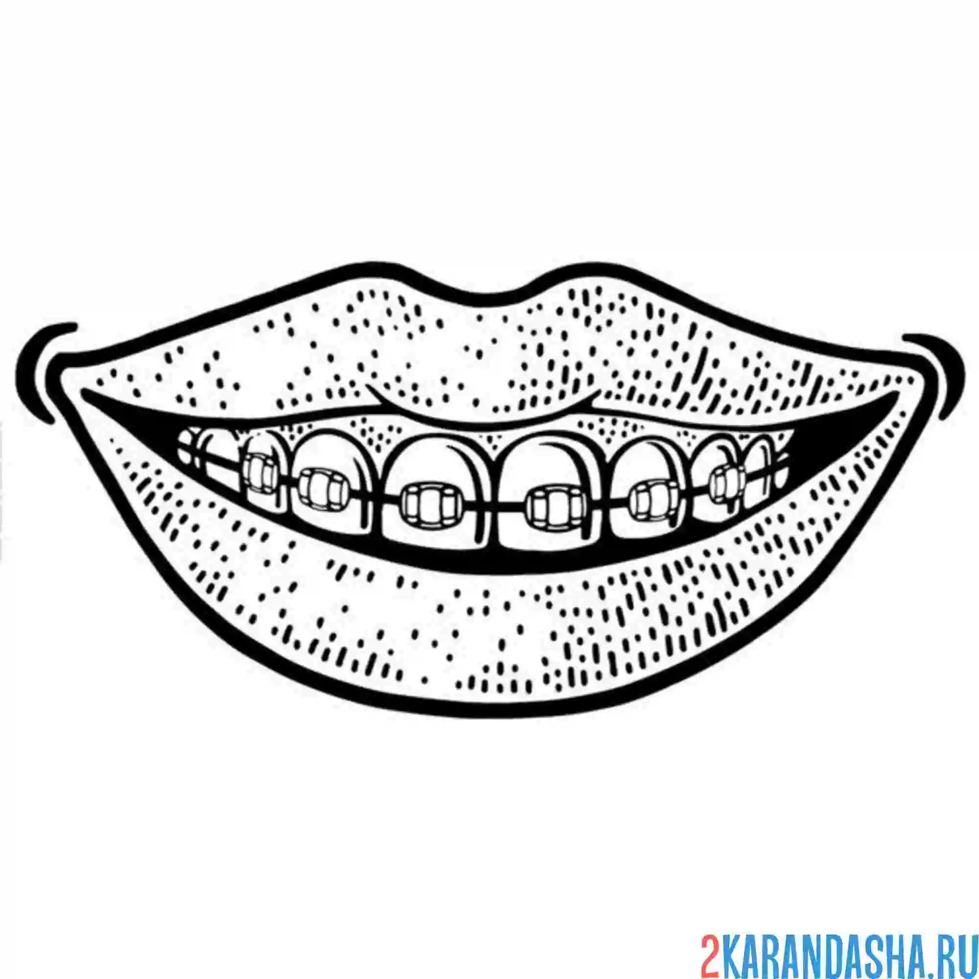 Раскраска брекеты рот зубы
